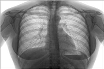 Point of Care Asthma image
